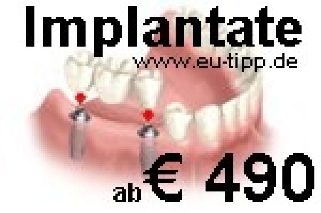 Zahn Behandlung Cz Gunstiger Als Ungarn Polen Implantate 490 Dienstleistungen 24 Net